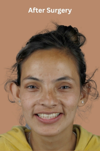 23