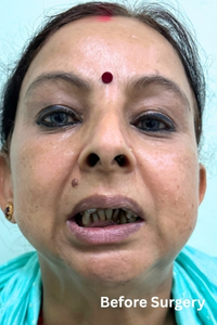 29